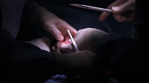 Doctors performing surgery on a patient Stock Footage 62389040