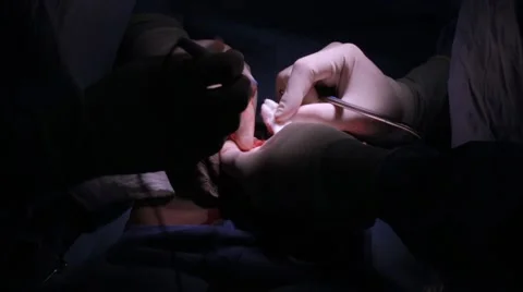 Doctors performing surgery on a patient Stock Footage 62389045