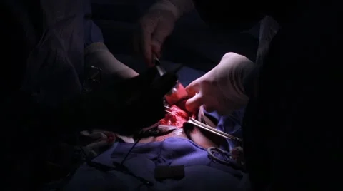 Doctors performing surgery on a patient Stock Footage 62389055
