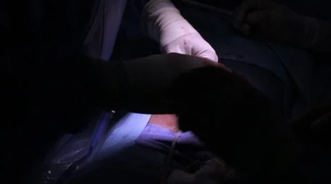 Doctors performing surgery on a patient Stock Footage 62389061