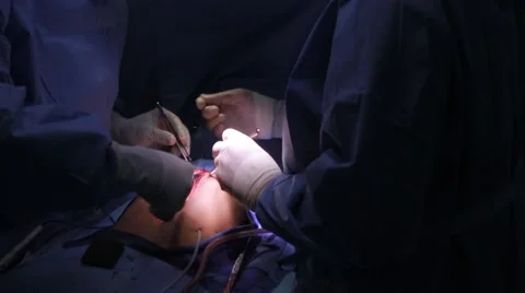 Doctors performing surgery on a patient Stock Footage 62389063