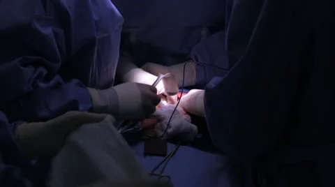 Doctors performing surgery on a patient in operation theater Stock Footage 62389068