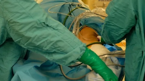 Doctors prepare the patient for surgery Stock Footage 90819555