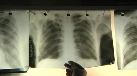 Doctors regard X-ray 2 Stock Footage 10590015