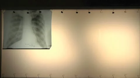 Doctors regard X-ray Stock-Footage 10590008