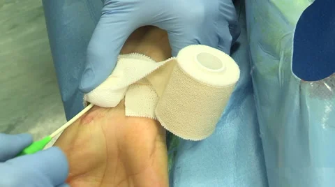 Doctors removing needle from patient's arm Stock Footage 45900698