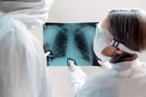 Doctors standing on white background examine x-ray for pneumonia of a Covid-19 Stock Photos