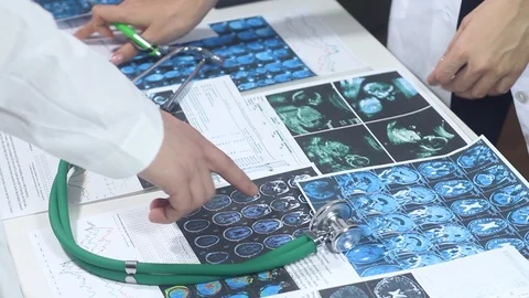 Doctors study with a chart in the hospital office Stock Footage 86690447