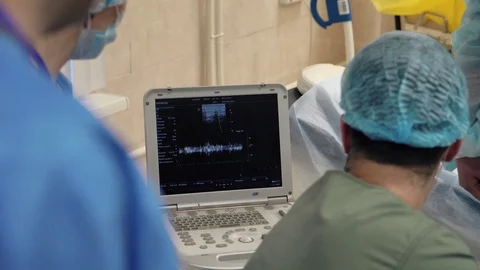 Doctors surgeons do the operation and look at the monitor of medical equipment. Stock Footage 126746509