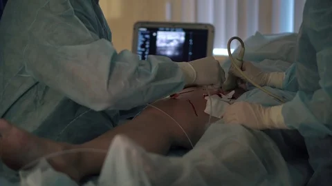 Doctors surgeons do surgery on the leg with special equipment in the operating Stock Footage 126746672