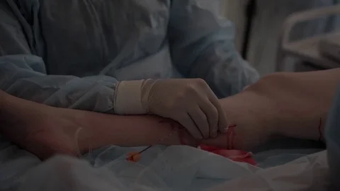 Doctors surgeons do surgery on the leg with special equipment in the operating Stock Footage 126746796