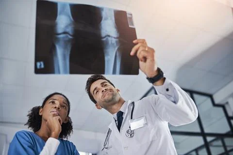 Doctors, teamwork or xray analysis in hospital for joint dislocation, resul.. Stock Photos