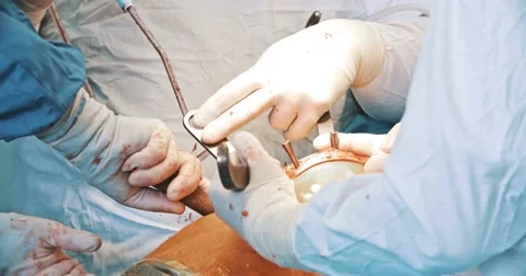 Doctors with tools in hands Stock Footage 50712057