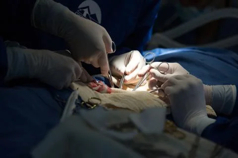 Doctors work on abdomen during surgery Foto stock