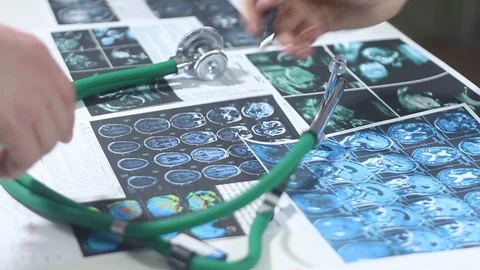 Doctors work with diagrams in the office Stock Footage 86690481