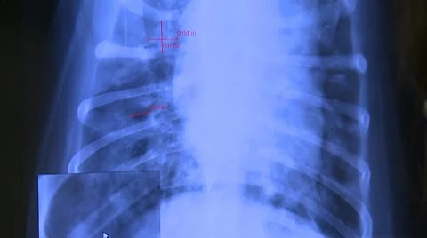 Dog x-ray 02 HD Stock Footage 10740774