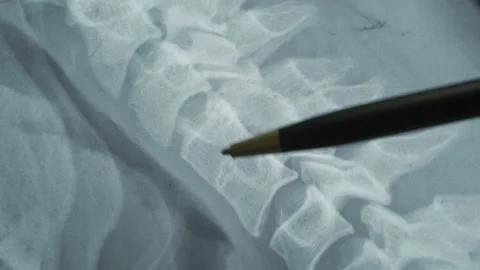 Dolly shot of x-ray image Stock Footage 99183075