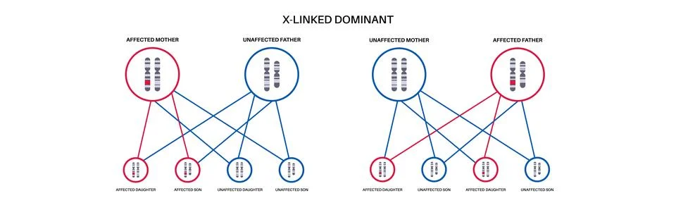Dominant inheritance pattern Illustrazione stock