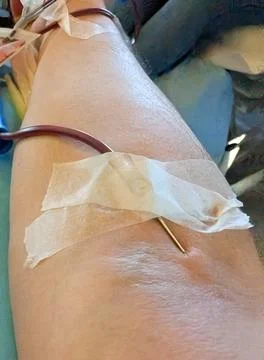 Donating blood or taking samples from an arm in a clinical setting Fotos Stock