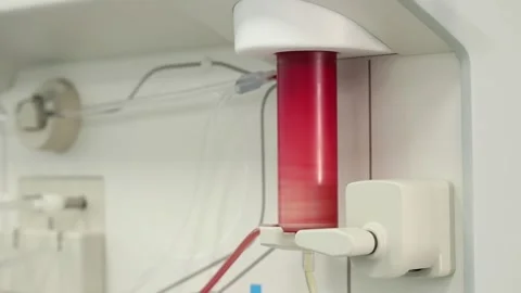 Donor blood transfusion device close-up Stock Footage 304124980