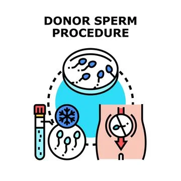 Donor sperm procedure process for fertility treatment Stock Illustration