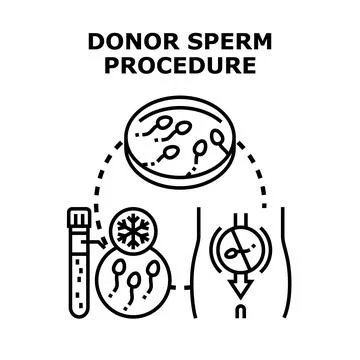 Donor sperm procedure process for fertility treatment Stock Illustration