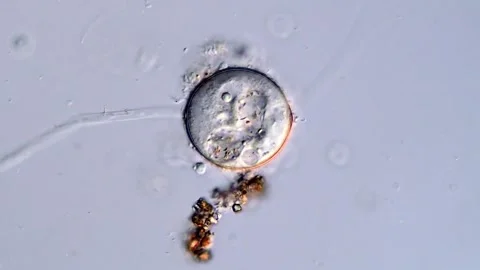 Dormancy of Vorticella under microscope Vídeos de archivo 310642150