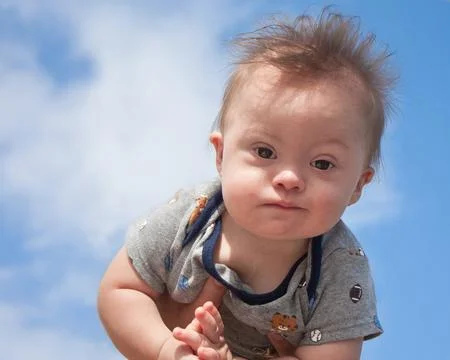 Down Syndrome Boy Stock-Fotos