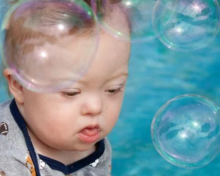 Down Syndrome Boy Stock Photos