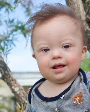 Down Syndrome Boy Stock-Fotos
