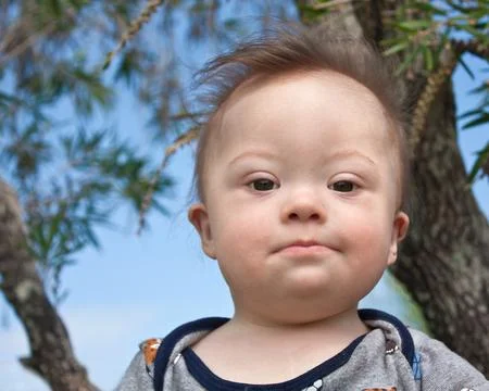Down Syndrome Boy Stock Photos