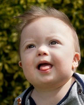 Down Syndrome Boy Stock-Fotos