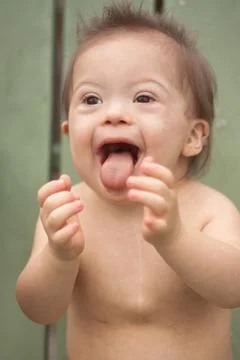 Down Syndrome Boy Stock-Fotos