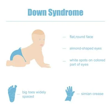 Down Syndrome Stock Illustration