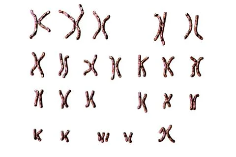 Down's syndrome karyotype, illustration Ilustração Stock