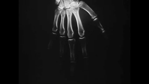 Dr. William Coolidge speaks about how he perfected x ray technology. Stock Footage 88826393