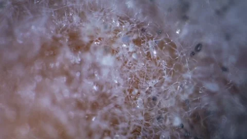 Dramatic extreme macro timelapse showing dark mold spores colonizing a white... Stock Footage 341773544
