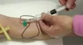 drawing blood HD Footage