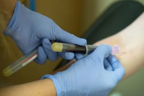Drawing Blood Stock Photos