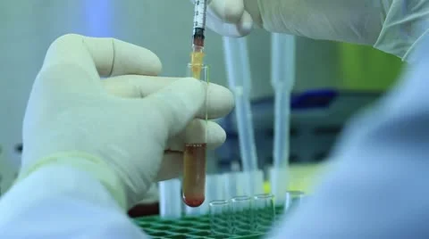 Drawing blood from test tubes with needle Stock Footage 20450409