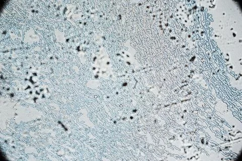 Dried human ejaculate texture with salt crystals under a light microscope Photos