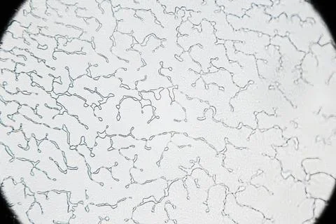 Dried human ejaculate texture under a light microscope Photos