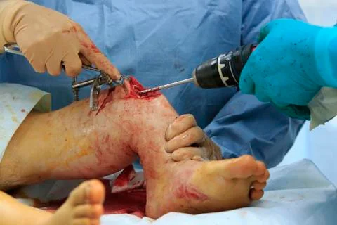 Drill the Shin 写真素材