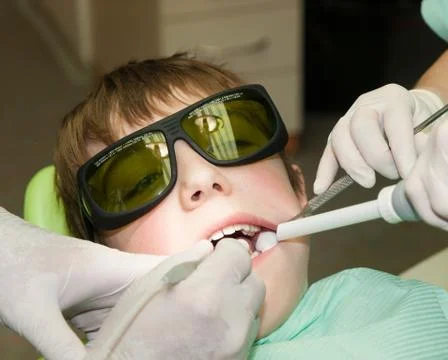 Drilling of tooth Stock Photos