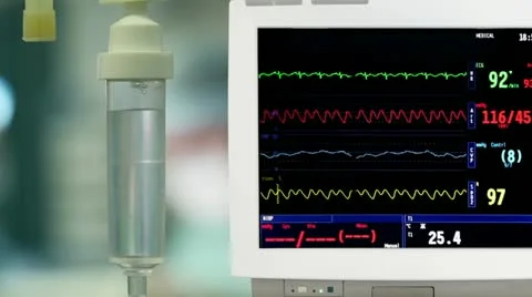 Drip with ECG monitor in operation room. Stock Footage