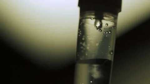 Drip-feed in action Stock Footage 45241514