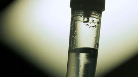 Drip-feed in action Stock Footage 45755440