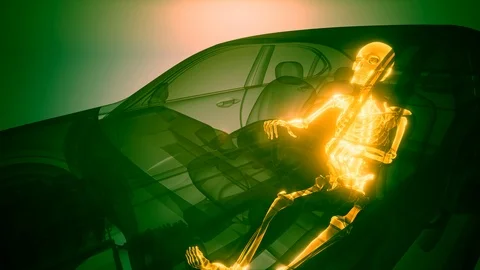 Driver with Visible Bones Stock Footage 88922235