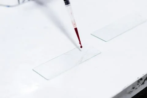 Drop of blood on a glass slide using micropipette microtip Stock Photos