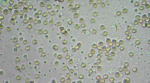 Drop of my blood under microscope Stockbeeldmateriaal 33661110